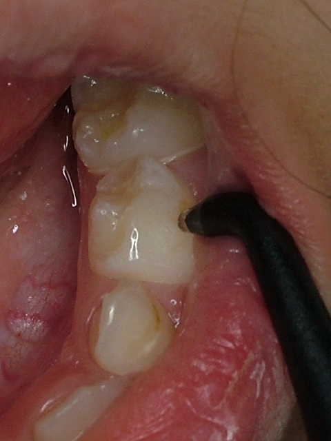 ���j�C���[�W