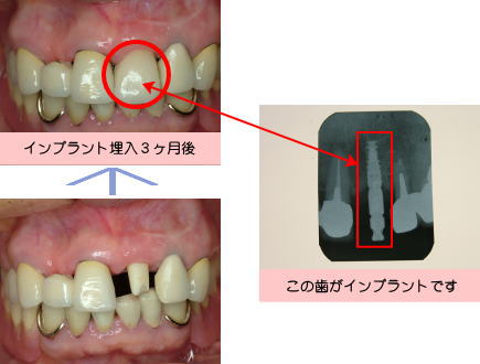 ���j�C���[�W